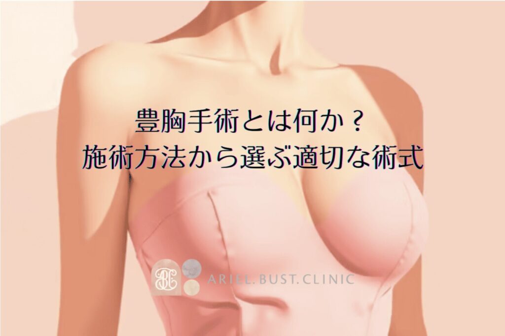 豊胸手術とはなにか？