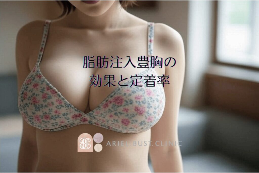 脂肪注入豊胸の効果と定着率｜術後経過の実際